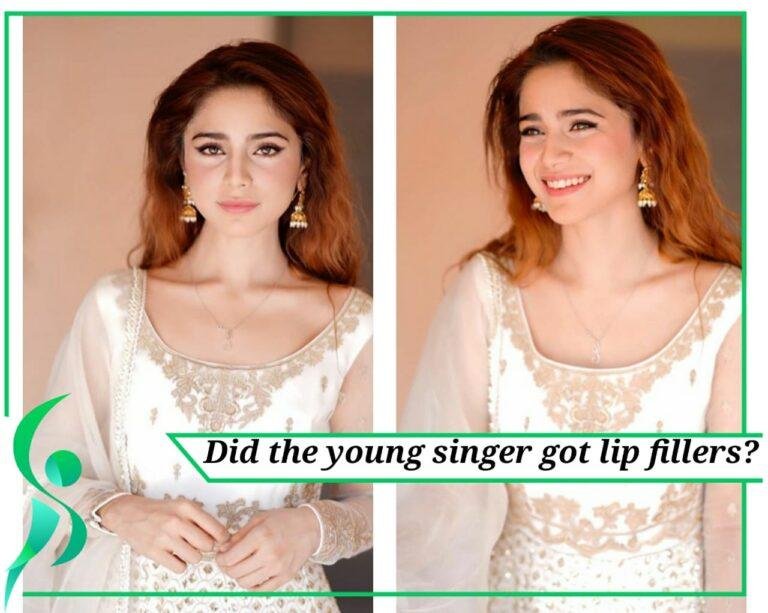 Aima Baig got lip fillers.