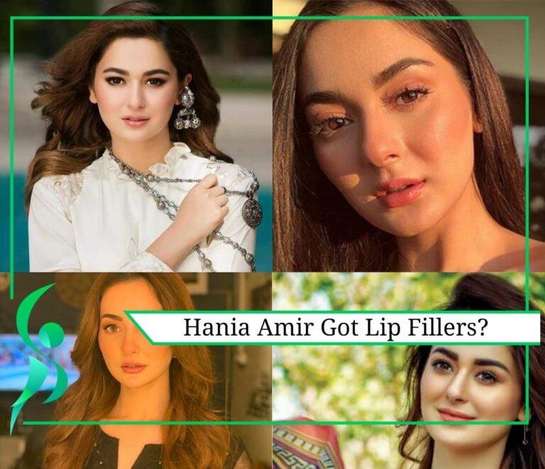 Hania Amir Lip Fillers Goes Wrong? Proven!