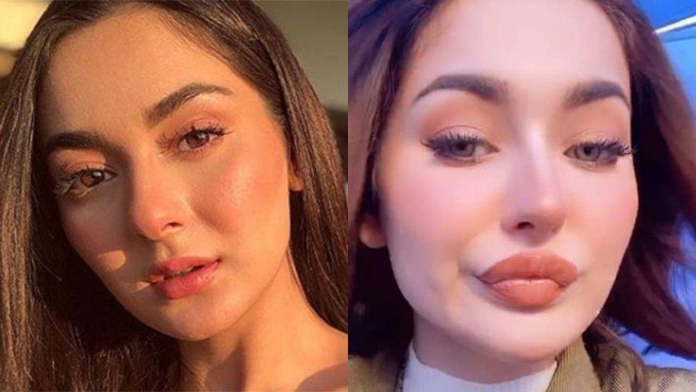 The truth about Hania Amir's perfect pout