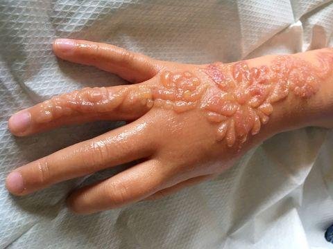 Shaista Lodhi talks mehendi, how it can destroy your skin